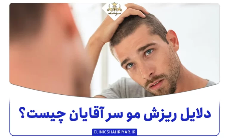 دلایل ریزش مو سر آقایان چیست؟ راه های جلوگیری از آن