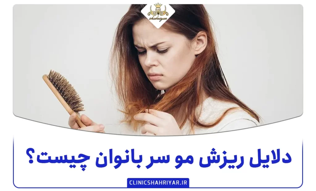 دلایل ریزش مو سر بانوان چیست؟ راه های جلوگیری از آن