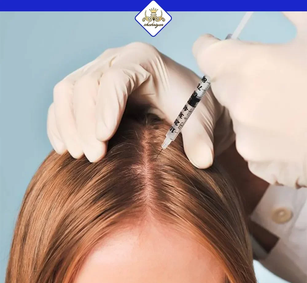 مزوتراپی مو چیست ؟ بررسی مزایا و معایب