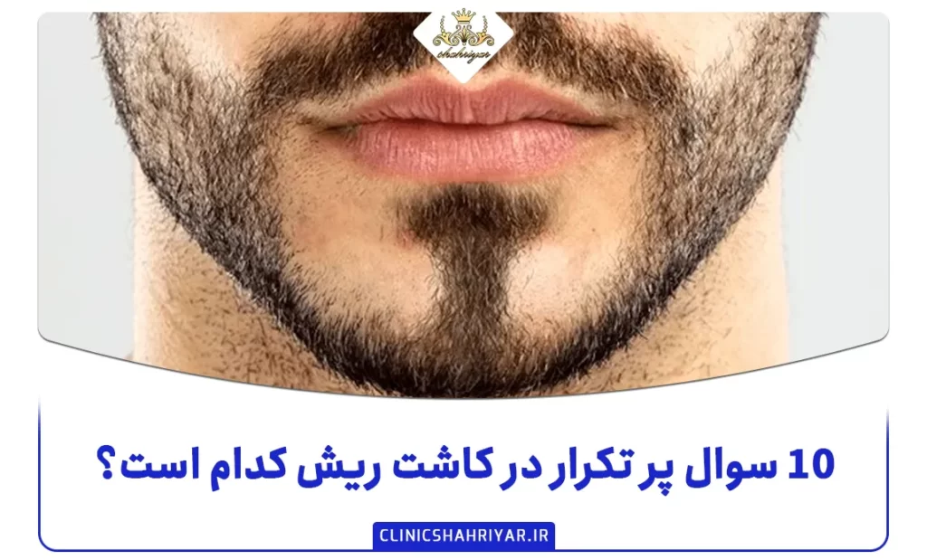 ۱۰ سوال پر تکرار در کاشت ریش کدام است؟