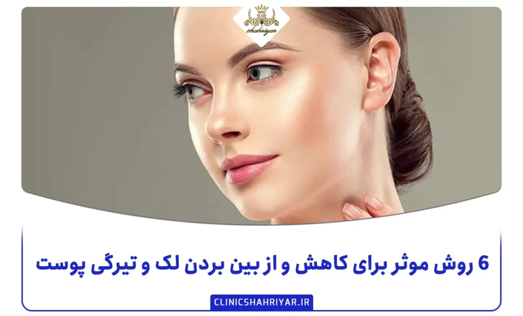 ۶ روش موثر برای کاهش و از بین بردن لک و تیرگی پوست