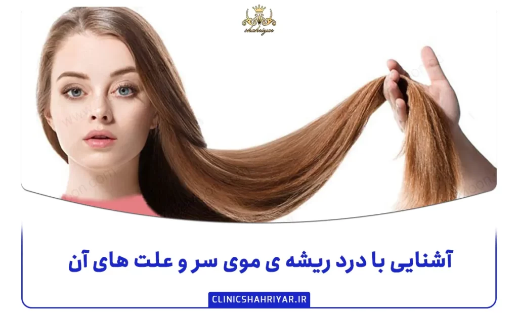 آشنایی با درد ریشه ی موی سر و علت های آن_کلینیک شهریار