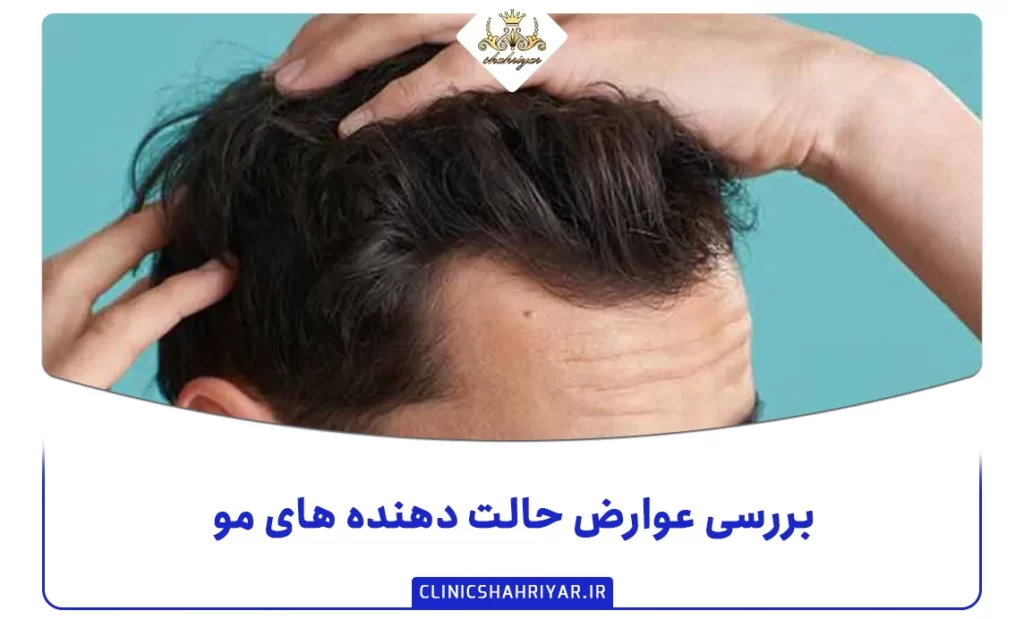 بررسی عوارض حالت دهنده های مو_کلینیک شهریار