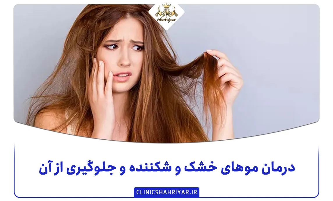 درمان موهای خشک و شکننده و جلوگیری از آن_کلینیک شهریار