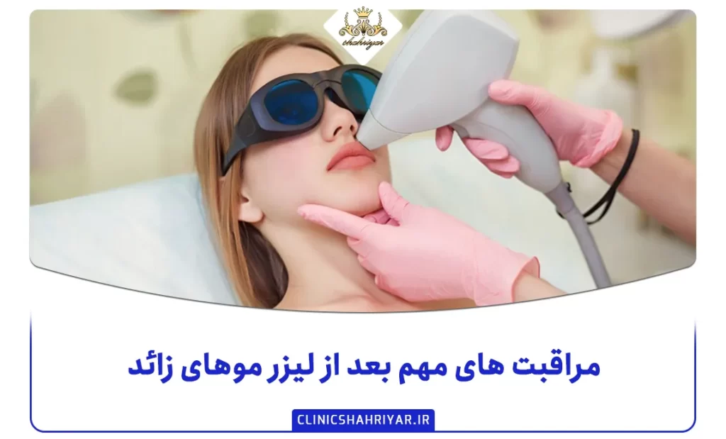 مراقبت های مهم بعد از لیزر موهای زائد_کلینیک شهریار