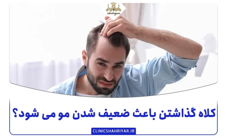 کلاه گذاشتن باعث ضعیف شدن مو می شود؟_کلینیک شهریار