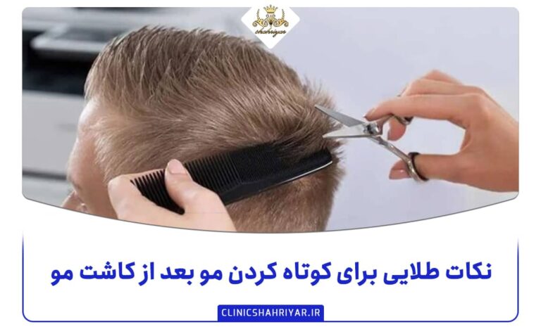 نکات طلایی برای کوتاه کردن مو بعد از کاشت مو_کلینیک شهریار