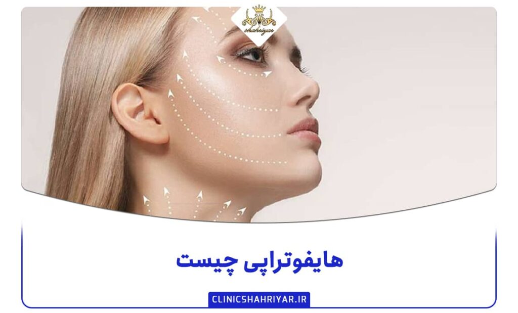 هایفوتراپی چیست؟ بررسی مزایا و معایب هایفوتراپی_کلینیک شهریار