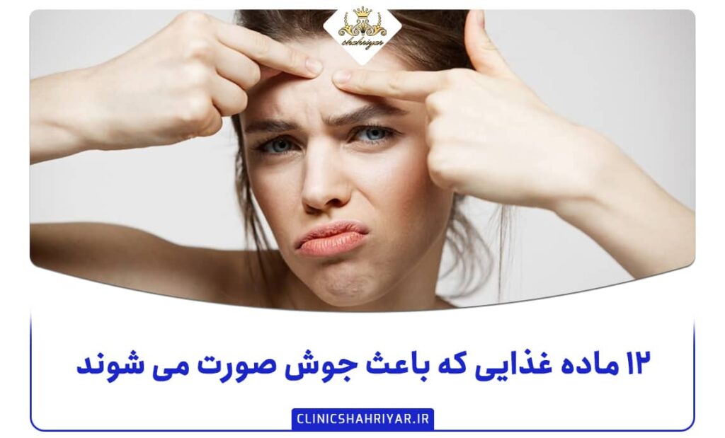 ۱۲ ماده غذایی که باعث جوش صورت می‌شوند_کلینیک شهریار