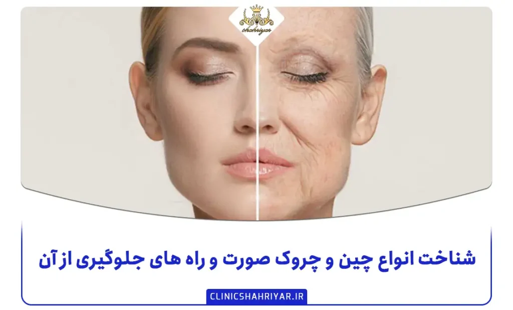 شناخت انواع چین و چروک صورت و راه های جلوگیری از آن_کلینیک شهریار